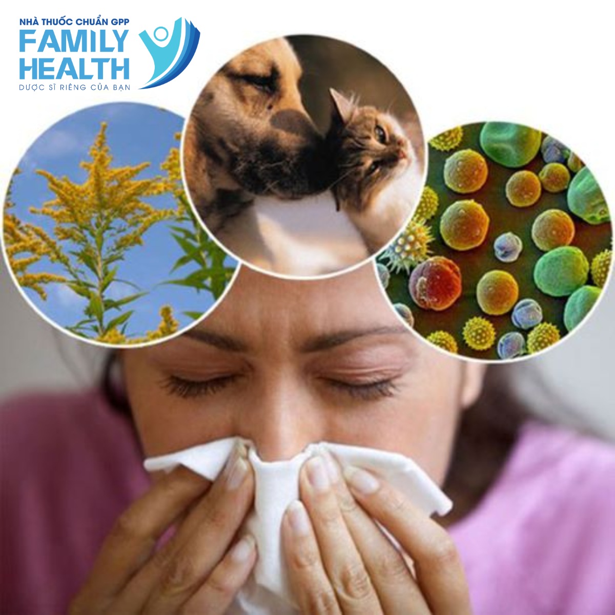 VIÊM MŨI DỊ ỨNG: NGUYÊN NHÂN, TRIỆU CHỨNG VÀ ĐIỀU TRỊ
